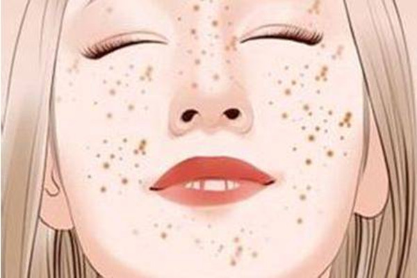 曬斑可以自然消失嗎 曬斑可以用激光去掉嗎 曬斑可以自然消失嗎 曬斑可以用激光去掉嗎