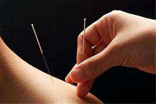 針灸的功效和作用 針灸是什么感覺 針灸的功效和作用 針灸是什么感覺