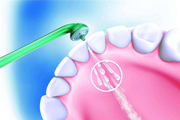 洗牙是掛什么科 洗牙用什么洗的干凈 洗牙是掛什么科 洗牙用什么洗的干凈