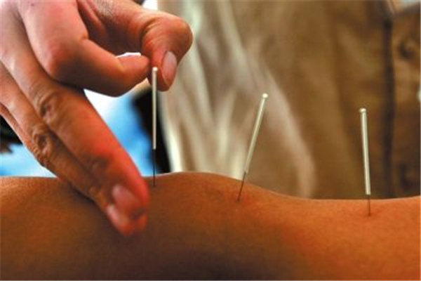 針灸可以豐胸嗎 針灸對女性有什么好處 針灸可以豐胸嗎 針灸對女性有什么好處