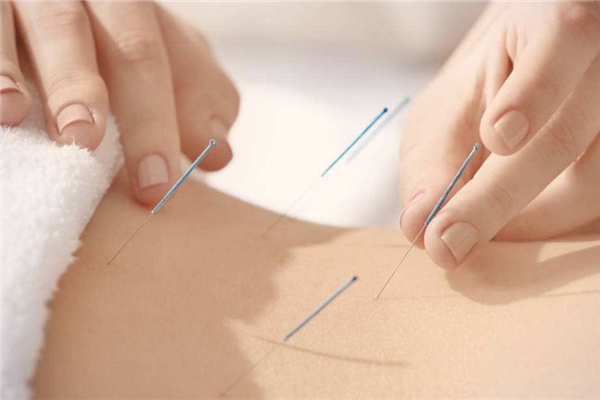 針灸對(duì)腰間盤(pán)突出有用嗎 針灸是什么原理治病