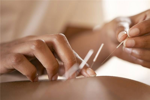 針灸有科學(xué)依據(jù)嗎 針灸有什么副作用 針灸有科學(xué)依據(jù)嗎 針灸有什么副作用