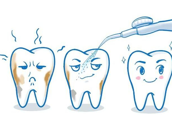洗牙有必要洗牙根內(nèi)部嗎 洗牙洗的是什么 洗牙有必要洗牙根內(nèi)部嗎 洗牙洗的是什么