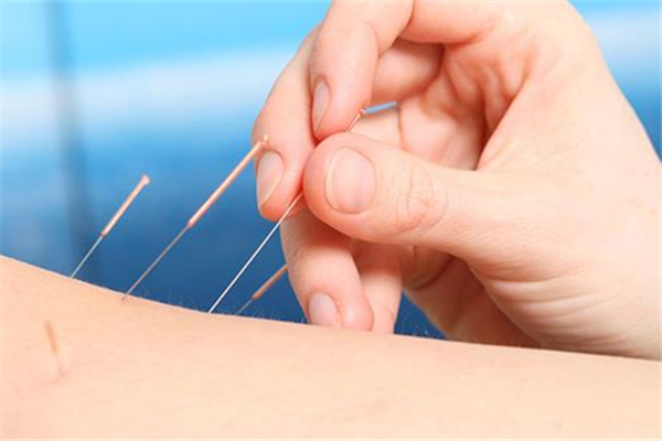 針灸要扎多久 針灸要注意哪些事項(xiàng) 針灸要扎多久 針灸要注意哪些事項(xiàng)