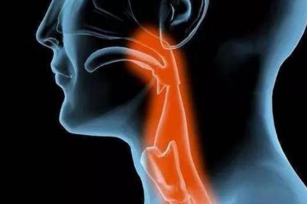 食道癌早期是什么癥狀 全球有一半食道癌患者在中國 食道癌早期是什么癥狀 全球有一半食道癌患者在中國