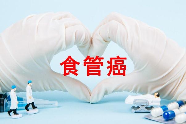 食道癌早期是什么癥狀 全球有一半食道癌患者在中國 食道癌早期是什么癥狀 全球有一半食道癌患者在中國