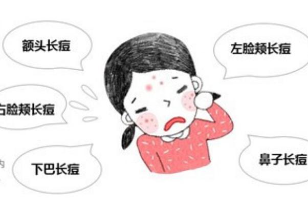 青春痘是皮膚病嗎 青春痘要擠掉嗎 青春痘是皮膚病嗎 青春痘要擠掉嗎