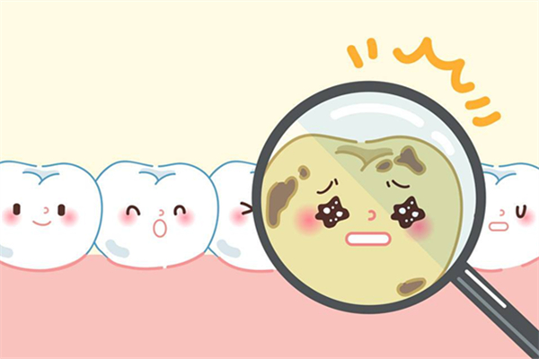 補牙前封牙是什么意思 補牙前為什么要塞藥一個星期