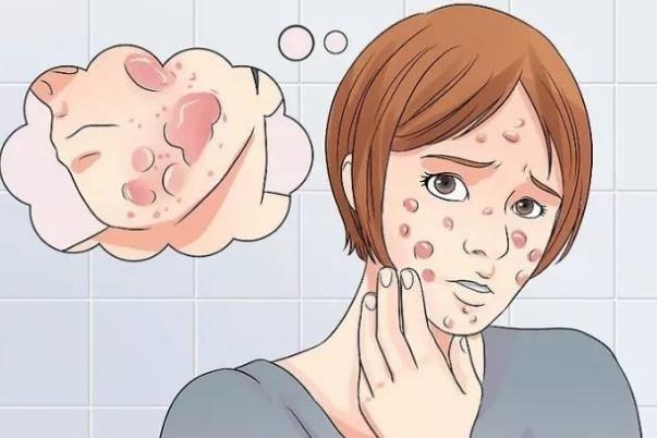 青春痘對身體有什么危害 長青春痘的好處與壞處 青春痘對身體有什么危害 長青春痘的好處與壞處