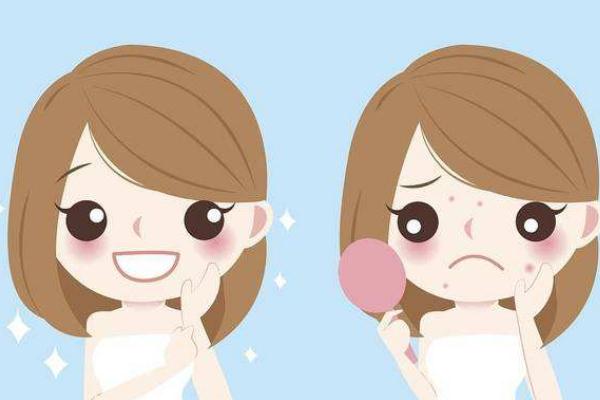 青春痘可以自愈嗎 青春痘可以用洗面奶嗎 青春痘可以自愈嗎 青春痘可以用洗面奶嗎