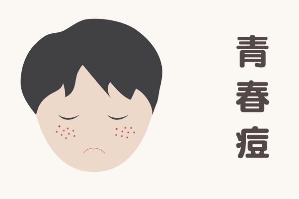 青春痘是怎么樣的 青春痘是螨蟲引起的嗎 青春痘是怎么樣的 青春痘是螨蟲引起的嗎
