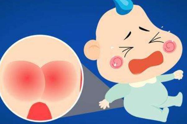 尿布疹是什么原因引起的 尿布疹是過敏嗎 尿布疹是什么原因引起的 尿布疹是過敏嗎