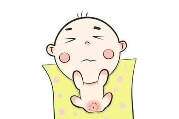 尿布疹是什么原因引起的 尿布疹是過敏嗎 尿布疹是什么原因引起的 尿布疹是過敏嗎