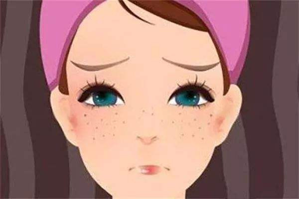 黃褐斑會(huì)不會(huì)傳染 黃褐斑會(huì)不會(huì)越來越嚴(yán)重