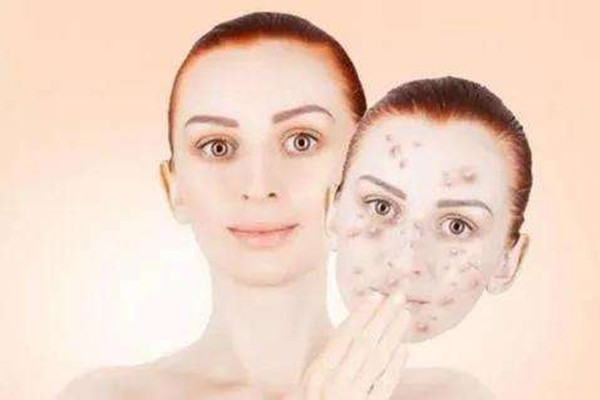 黃瓜敷臉能去黃褐斑嗎 白醋洗臉可以去除黃褐斑嗎 黃瓜敷臉能去黃褐斑嗎 白醋洗臉可以去除黃褐斑嗎