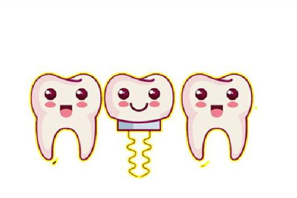 種牙會(huì)疼嗎 種牙后疼痛多長(zhǎng)時(shí)間能好 種牙會(huì)疼嗎 種牙后疼痛多長(zhǎng)時(shí)間能好