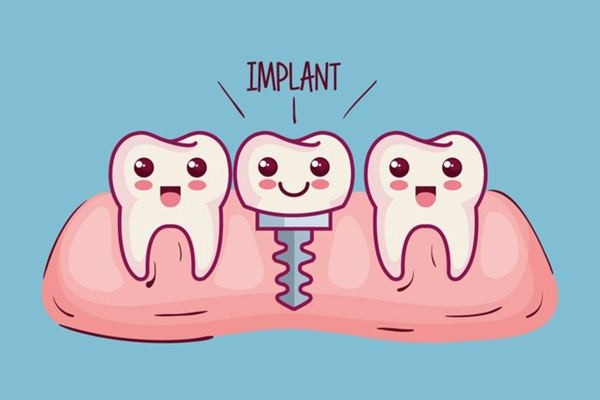 種牙多少錢一顆啊 種牙需要多少時間 種牙多少錢一顆啊 種牙需要多少時間
