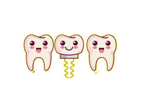 種牙去醫(yī)院還是口腔診所 種牙去私立好還是公立好 種牙去醫(yī)院還是口腔診所 種牙去私立好還是公立好