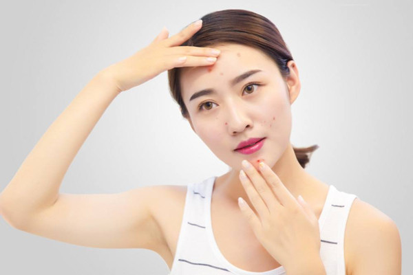 粉刺起膿包怎么辦 粉刺很癢是怎么回事 粉刺起膿包怎么辦 粉刺很癢是怎么回事