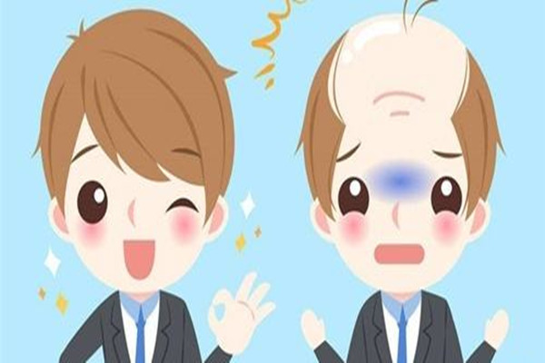 植發(fā)前需要做哪些準(zhǔn)備 植發(fā)前驗(yàn)血是要檢查什么 植發(fā)前需要做哪些準(zhǔn)備 植發(fā)前驗(yàn)血是要檢查什么