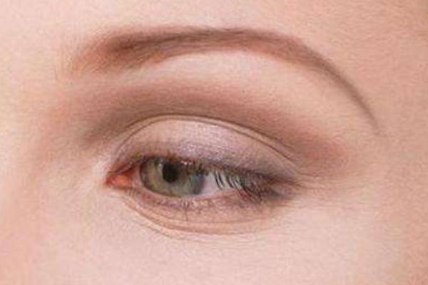 魚尾紋要怎樣淡化 魚尾紋要怎么食補 魚尾紋要怎樣淡化 魚尾紋要怎么食補