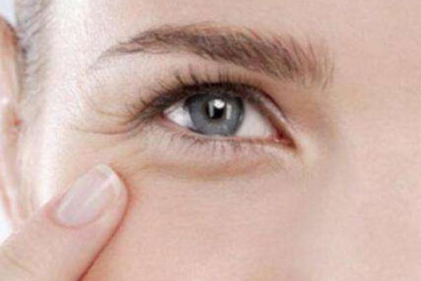 魚尾紋怎么才能去掉 魚尾紋是哪個(gè)部位 魚尾紋怎么才能去掉 魚尾紋是哪個(gè)部位