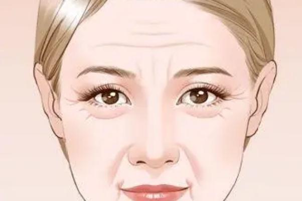 抬頭紋要不要去除 抬頭紋要打多少肉毒素 抬頭紋要不要去除 抬頭紋要打多少肉毒素