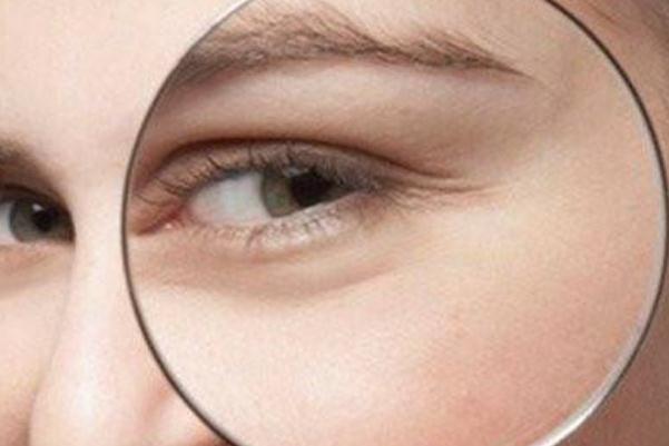 魚尾紋要怎樣淡化 魚尾紋要怎么食補 魚尾紋要怎樣淡化 魚尾紋要怎么食補