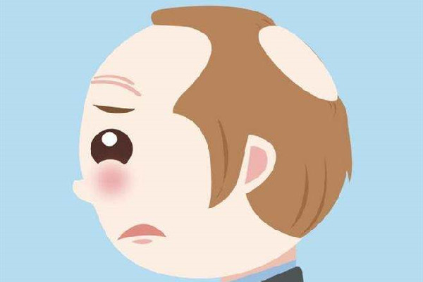 植發(fā)用的是哪里的毛囊 植發(fā)會不會有什么副作用 植發(fā)用的是哪里的毛囊 植發(fā)會不會有什么副作用