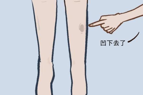 水腫是什么意思 過敏性水腫癥狀有哪些