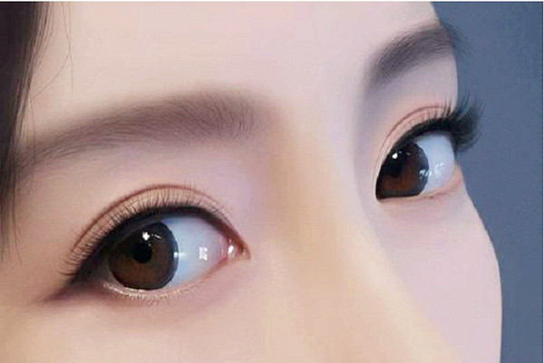 雙眼皮埋線后多久可以沾水 雙眼皮埋線后多久可以化妝 雙眼皮埋線后多久可以沾水 雙眼皮埋線后多久可以化妝