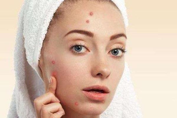 痘痘肌膚怎么修復(fù) 痘痘肌膚適合用什么牌子的護膚品 痘痘肌膚怎么修復(fù) 痘痘肌膚適合用什么牌子的護膚品