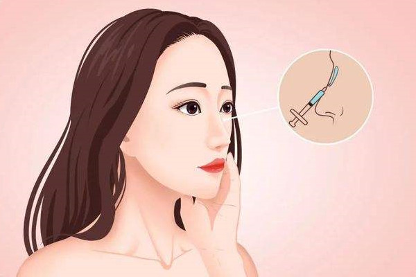 隆鼻只可以做山根嗎 隆鼻怎么做 隆鼻只可以做山根嗎 隆鼻怎么做