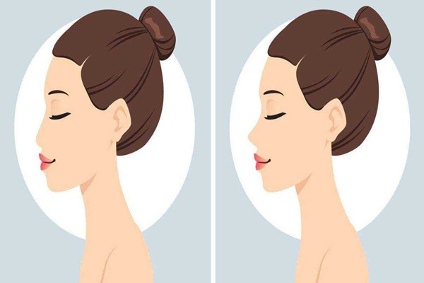 隆鼻只可以做山根嗎 隆鼻怎么做 隆鼻只可以做山根嗎 隆鼻怎么做