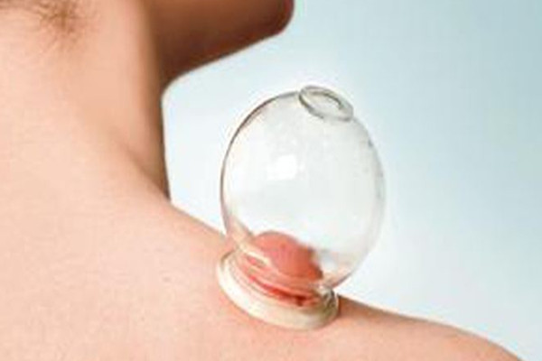 拔火罐是什么原理 拔火罐能去除濕氣嗎 拔火罐是什么原理 拔火罐能去除濕氣嗎