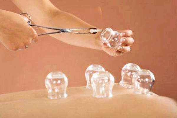 拔火罐能天天撥嗎 拔火罐多久一次比較好 拔火罐能天天撥嗎 拔火罐多久一次比較好