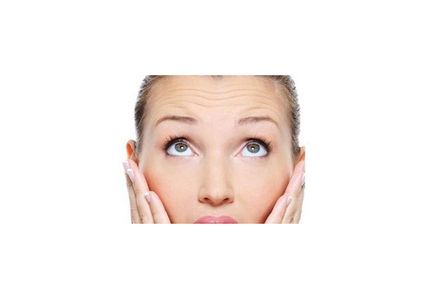 抬頭紋是怎樣形成的 抬頭紋可以去除嗎 抬頭紋是怎樣形成的 抬頭紋可以去除嗎