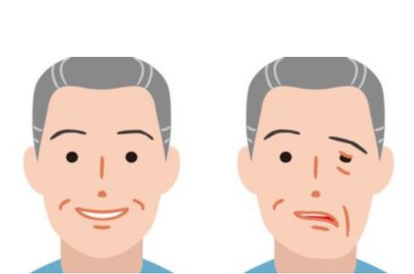 面癱是什么病 女子回家路上被冷風(fēng)吹成面癱 面癱是什么病 女子回家路上被冷風(fēng)吹成面癱