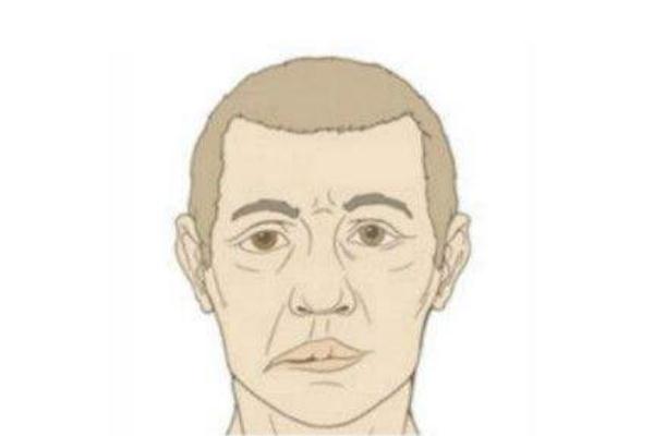 面癱是什么病 女子回家路上被冷風(fēng)吹成面癱 面癱是什么病 女子回家路上被冷風(fēng)吹成面癱