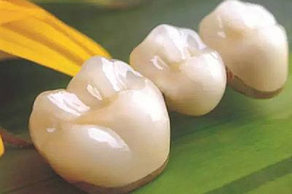 烤瓷牙里面臭了怎么辦 烤瓷牙怎么清洗里面 烤瓷牙里面臭了怎么辦 烤瓷牙怎么清洗里面