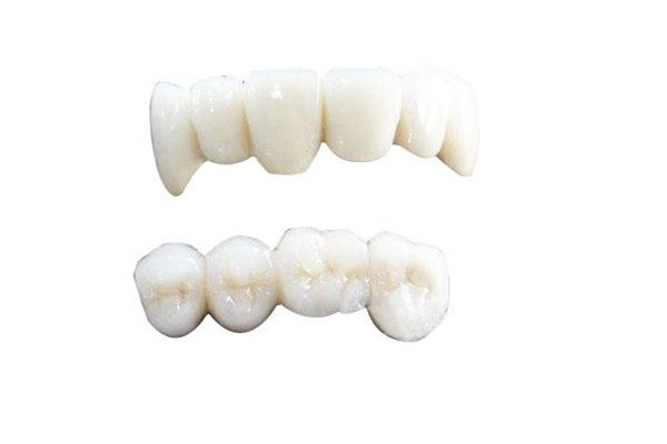 烤瓷牙會(huì)對(duì)原來(lái)的牙齒有影響嗎 烤瓷牙的利弊