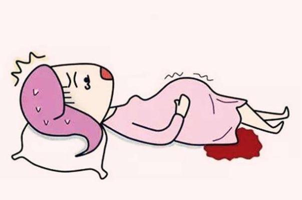 孕婦流產(chǎn)是什么感覺 孕婦流產(chǎn)要休息多久 孕婦流產(chǎn)是什么感覺 孕婦流產(chǎn)要休息多久