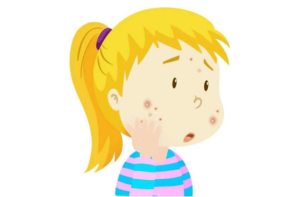 脂肪粒會(huì)復(fù)發(fā)嗎 脂肪粒能自己脫落嗎 脂肪粒會(huì)復(fù)發(fā)嗎 脂肪粒能自己脫落嗎