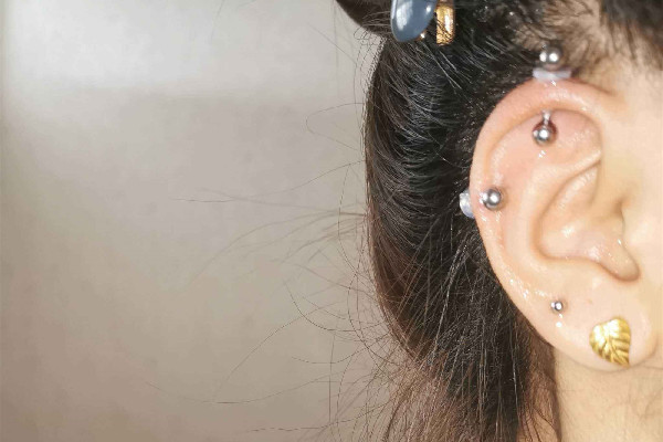 打耳骨后面長了個肉坨坨怎么處理 打耳骨有什么風(fēng)險 打耳骨后面長了個肉坨坨怎么處理 打耳骨有什么風(fēng)險