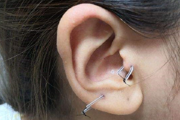 打耳骨要多久恢復期 打耳骨釘之后多久可以換耳釘 打耳骨要多久恢復期 打耳骨釘之后多久可以換耳釘