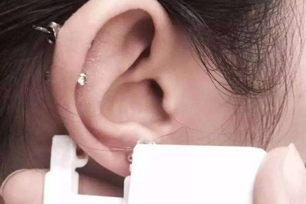 打耳骨后面長了個肉坨坨怎么處理 打耳骨有什么風(fēng)險 打耳骨后面長了個肉坨坨怎么處理 打耳骨有什么風(fēng)險