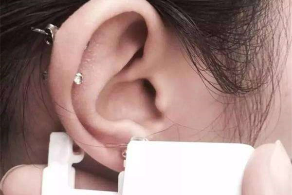 打耳骨需要去醫(yī)院嗎 打耳骨去哪打比較安全 打耳骨需要去醫(yī)院嗎 打耳骨去哪打比較安全