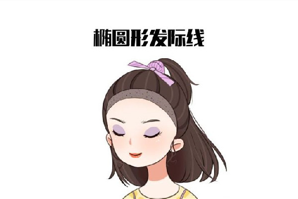 發(fā)際線后移怎么恢復(fù) 發(fā)際線后移是什么原因引起的 發(fā)際線后移怎么恢復(fù) 發(fā)際線后移是什么原因引起的