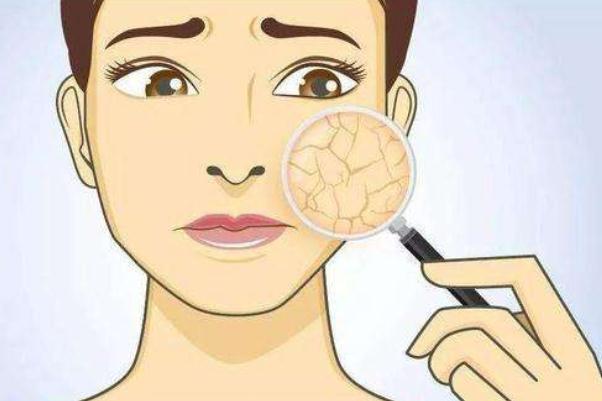 皮膚干燥脫皮嚴(yán)重像魚鱗怎么辦 皮膚干燥起皮像魚鱗是怎么回事 皮膚干燥脫皮嚴(yán)重像魚鱗怎么辦 皮膚干燥起皮像魚鱗是怎么回事