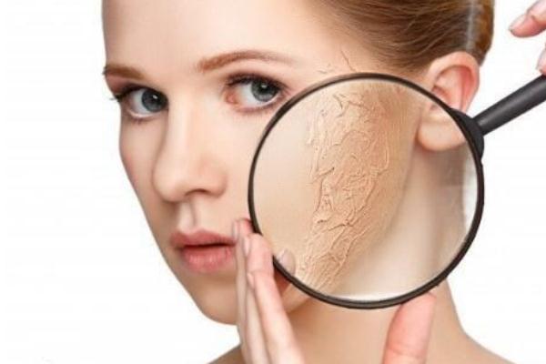 皮膚干燥脫皮嚴(yán)重像魚鱗怎么辦 皮膚干燥起皮像魚鱗是怎么回事 皮膚干燥脫皮嚴(yán)重像魚鱗怎么辦 皮膚干燥起皮像魚鱗是怎么回事